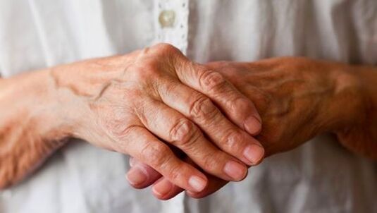 reumatoïde artritis als oorzaak van pijn in de gewrichten van de vingers