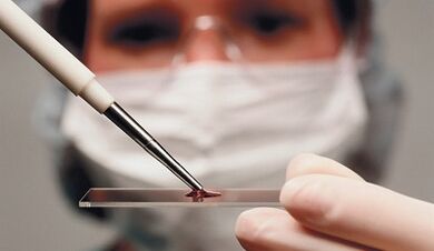 Differentiële diagnose van attribuut en artrose