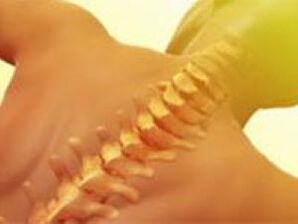 osteochondrose - wervelkolomziekte